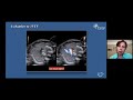 How to improve sequential segmental analysis on fetal heart - with Prof. Dr. Julene Carvalho