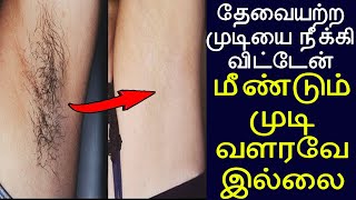 தேவையற்ற-முடியை-நீக்கி-விட்டேன்-முடி-வளரவே-இல்லை | unwanted hair removing in tamil | akkul mudi poga