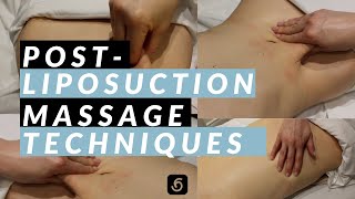 Post-Liposuction Massage Techniques [Dr. Martin Jugenburg aka Dr Six]