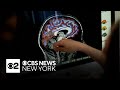 Brains change profoundly during pregnancy, research shows