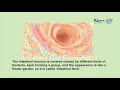 eria functional recovery care episode 10 importance of peristalsis and intestinal bacteria