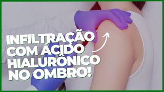 INFILTRAÇÃO COM ÁCIDO NO OMBRO, JÁ VIU ISSO?  ›› DR RODRIGO PASTORE ‹‹