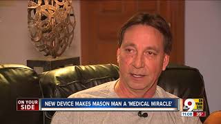 Mason man survives near-fatal 'widowmaker' heart attack thanks to a special live-saving LUCAS device