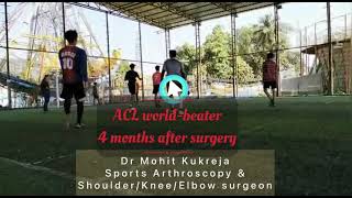 Happy patient diaries- ACL reconstruction with meniscus repair patient at 4 months after surgery