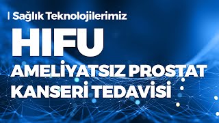 Sağlık Teknolojilerimiz: HIFU (Ameliyatsız Prostat Kanseri Tedavisi)