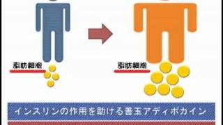 「徳島大学病院」TVいきいきらいふ第1回糖尿病の現状と仕組み.wmv