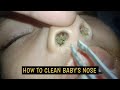 HOW TO CLEAN BABY'S NOSE