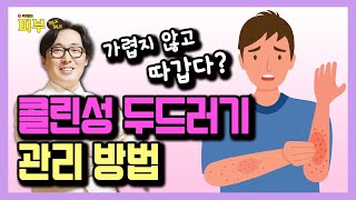 바늘로 찌르듯이 아픈 콜린성 두드러기 없애는 방법 - 박치영의 피부 톡톡 #13 콜린성두드러기 완치