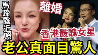 馬蹄露近照更嚇人！被封「香港最醜女藝人」離婚真相！老公真面目瞞不住！真情「乞人憎角色」深入民心！ 姚焯菲人生污點！#tvb #曾志偉