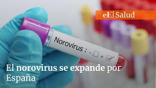 El norovirus se expande por España: los médicos informan de un aumento de casos en los ambulatorios