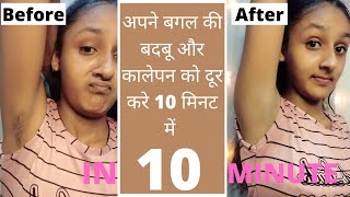 अपने बगल की बदबू और कालेपन को दूर करे 10 मिनट में| Underarms darkness removal  | Harshi makeup