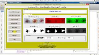 Blood Group Detection Using Image Processing Matlab Project with Source Code