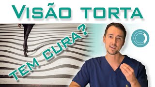 Visão distorcida tem cura? Tratamento da metamorfopsia.