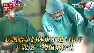 29岁孕妇怀孕双胞胎，怎料9个月体重还不足110斤，胎心时有时无，手术室内开腹惊现意外，这一物惊呆医生……【生命缘第2季】