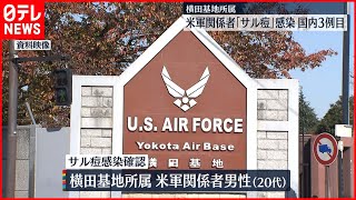 【サル痘】国内3例目のサル痘感染確認　米軍関係者の20代男性