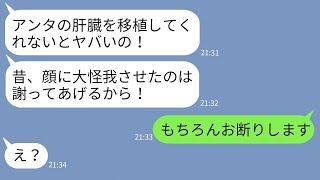 【LINE】妹の私を階段から落として顔に傷を負わせた姉が病気でドナーが必要に→適合者の私に提供を頼んできたので速攻で断った結果…w【総集編】