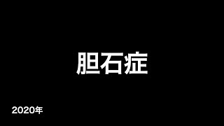 胆石症 (疫学・病態・症状・検査・診断・治療など...)