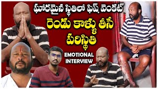 Actor Fish Venkat About His Health Condition | Fish Venkat Interview | TFPC