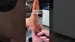 #발각질제거 #발각질관리