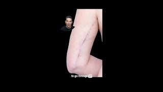 3 Types of Scars and What They Look Like
