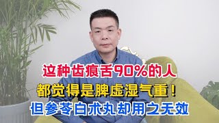 这种齿痕舌90%的人都觉得是脾虚湿气重！但参苓白术丸却用之无效