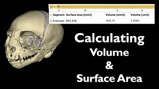 Calculating Volume & Surface Area [3D Slicer Workflow]