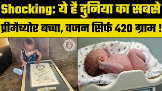 Baby born at 21 weeks: ये है दुनिया का सबसे प्रीमैच्योर बच्चा, वजन सिर्फ 420 ग्राम!