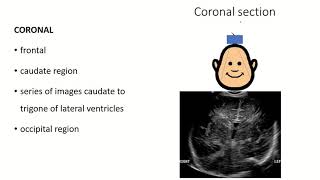 Fontanelle Insights: A Comprehensive Anatomy Guide with Clinical Insights