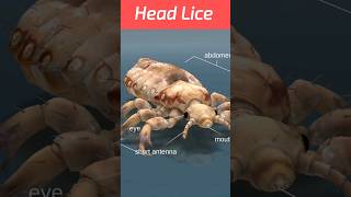 head lice I sir ki joon I #shortsvideo #3d(Animation)#shortsfeed