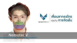 ศัลยกรรมเทคนิค  Nemotec V ที่  Vertex Clinic ที่เเรกที่เดียวในไทย