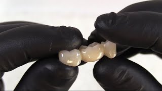 Using the eZr Adjustment/Polishing Kit for Zirconia \u0026 Lithium Disilicate with Dr. Armand Bedrossian