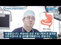 당뇨대사수술의 종류와 특징 김종민 원장 설명