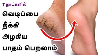 7 நாட்களில் கால்களில் உள்ள வெடிப்பு நீங்கி அழகிய பாதம் பெறலாம்.