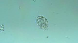 Ciliate: Holophrya