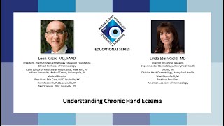 IDEF Educational Series  Understanding Chronic Hand Eczema