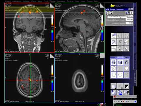Fmri Analysis Youtube