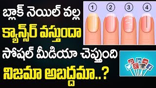 Causes Of Black Nail | How To Get Rid Of Black enails | Black Nail Cancer | Nail Problems