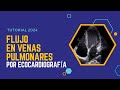 ✅FLUJO en VENAS PULMONARES por ECOCARDIOGRAFÍA: 🔊Guía Completa con Doppler