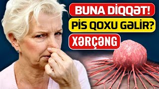 NƏCİSDƏN PİS QOXU GƏLİRSƏ - Xərçəng Xəstələrinin 90%-i Bunu Bilmir