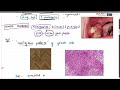 non epithelial tumors of oral cavity oral path part 1