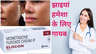 Elocon Cream Benefits | दाग, धब्बे मिटाने की सबसे असरदार क्रीम | elocon cream review in hindi |