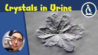 🔬 141 - How to observe URINE under the microscope  | Amateur Science