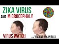 Virus Watch: Zika Virus and Microcephaly