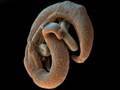 Monster Inside Me: Brain Invasion