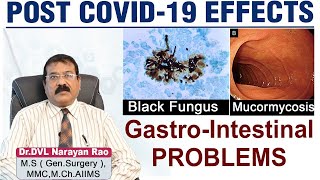 Gastrointestinal Symptoms of COVID 19 || Post COVID Symptoms || Dr DVL Narayan Rao || TX Hospitals