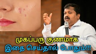 முகப்பரு வருவதற்கு காரணமும் தீர்வும் | Dr.Sivaraman speech on remedy for Pimples and Acne