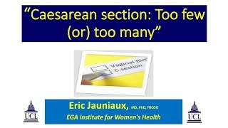 Lunch Hour Lecture: Caesarean section: Too few or Too many? Professor Eric Jauniaux