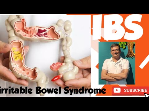 Irritable Bowel Syndrome | IBS | Colonoscopy #ajaykaushik # ...