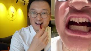 高露洁美白牙笔，牙医的心动与失望，Colgate whitening teeth