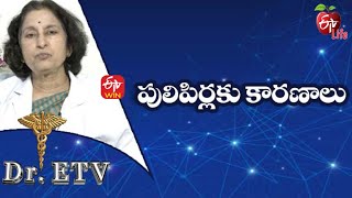 Warts - Causes | పులిపిర్లకు కారణాలు | Dr.ETV | 17th January 2022 | ETV Life